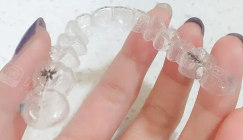 时代天使牙套照片