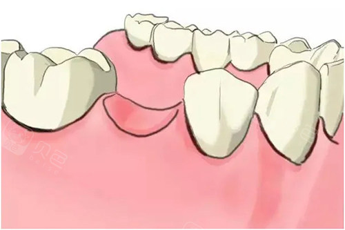 日本再生牙一万一颗正常吗?价格虽高但技术确实惊艳,值不值看完就知道