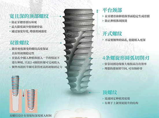 伊诺种植体和DIO种植体到底怎么选?一篇讲清两者特点与选择建议