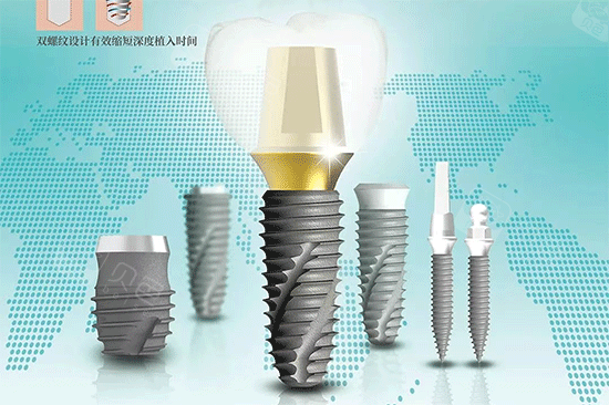 伊诺种植体和奥齿泰种植体真的能通用吗?适用范围与价格全解析