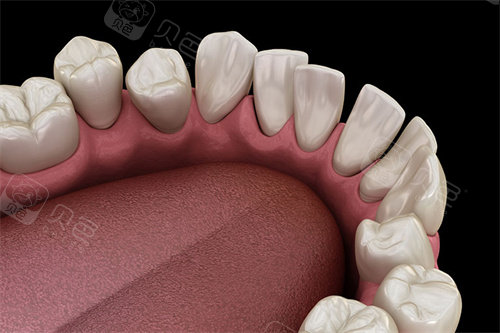 ems洁牙尖怎么分安顺市牙科口腔诊所哪家好？分享安顺牙齿矫正／种植牙正规口碑好十家口腔科｜技术靠谱价格透明_https://www.jmylbn.com_新闻资讯_第3张