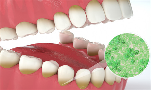 ems洁牙尖怎么分安顺市牙科口腔诊所哪家好？分享安顺牙齿矫正／种植牙正规口碑好十家口腔科｜技术靠谱价格透明_https://www.jmylbn.com_新闻资讯_第9张