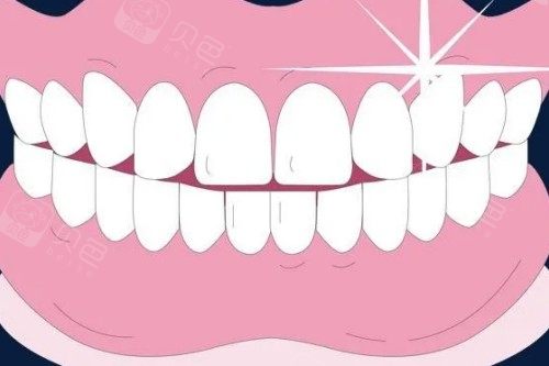 北京諾貝加爾口腔門診口碑怎么樣？營業時間到20:30，士卓曼種植6980元起