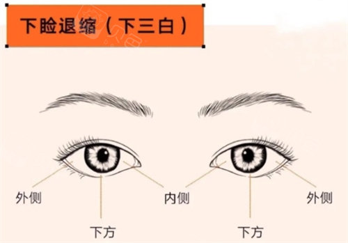 北京韩勋医生眼修复技术咋样？这份评价解析带你看清技术特点！