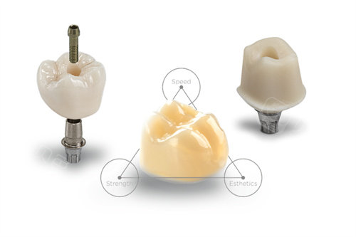 厦门全瓷牙做一颗价格是多少钱？爱尔创1500元起，威兰德2200元起！