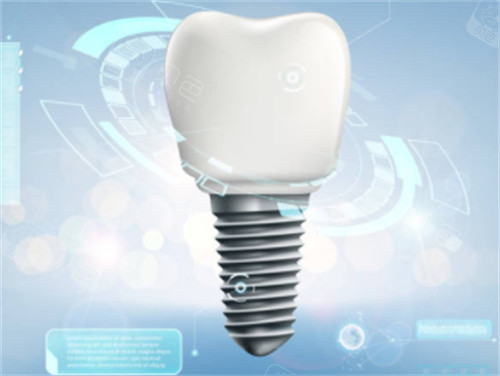 佛山爱顿口腔收费价格表：种植牙1980元起，隐形矫正14000元起