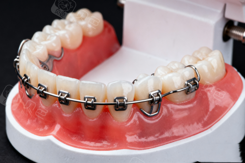 北京海淀牙齿矫正医院哪家好?极简海德堡口腔/雅德嘉口腔/中诺口腔正畸好