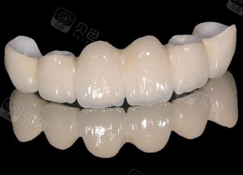 半口全瓷牙展示图