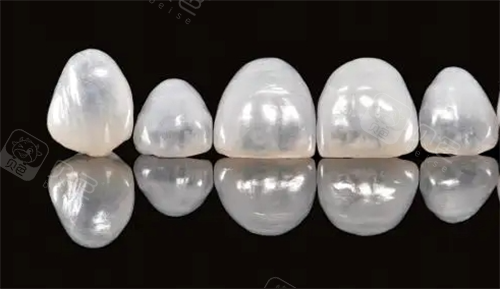 德国vita全瓷牙展示图