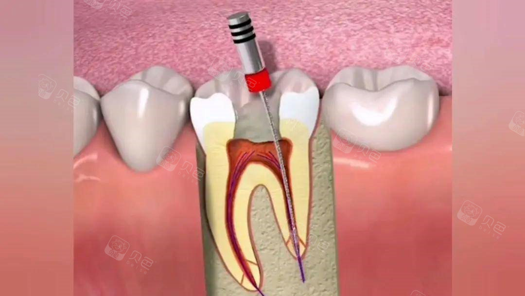 福州晋安艾莱口腔门诊部超可靠！轻牙科项目为主，体验舒适不痛苦