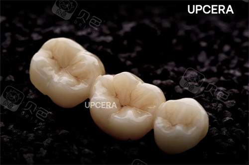 爱尔创-瓷倍健全瓷冠