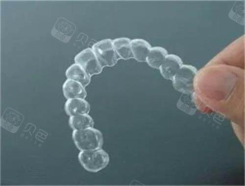 隐形牙齿矫正器示意图