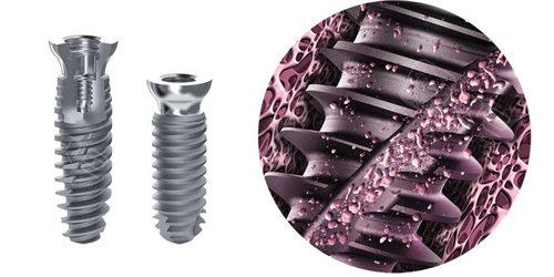 安卓健种植牙表面工艺