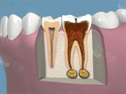 口腔高速手机怎么修社畜看牙记：在德伦口腔看牙，根管治疗全程温柔沟通，我居然舒服到睡着_https://www.jmylbn.com_新闻资讯_第1张
