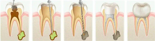 口腔高速手机怎么修社畜看牙记：在德伦口腔看牙，根管治疗全程温柔沟通，我居然舒服到睡着_https://www.jmylbn.com_新闻资讯_第3张