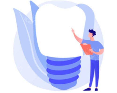 种植牙科普知识图