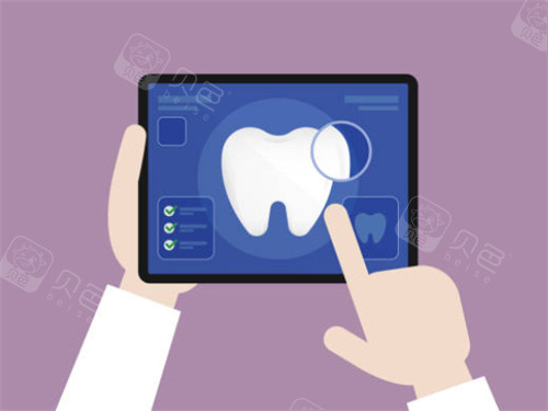 种植牙检查平板图