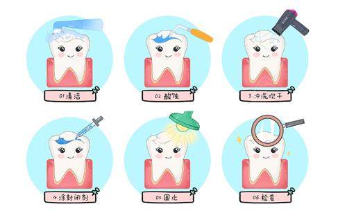 氟防龋材料怎么用窝沟封闭儿童有必要做吗？省钱防蛀vs材料脱落，家长正反意见大碰撞必看_https://www.jmylbn.com_新闻资讯_第3张