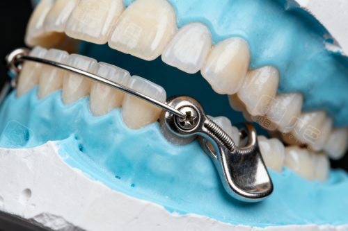 牙科骨凿怎么用2026呼和浩特口腔医院收费价目表：洗牙60+／补牙200+／种植牙2980+／牙齿矫正5000+，预算要做好！_https://www.jmylbn.com_新闻资讯_第3张