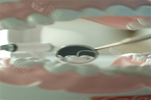 口腔修复液怎么用牙齿修复液真的有用吗？牙釉质修复液新消息来了，上市时间终于确定！_https://www.jmylbn.com_新闻资讯_第3张