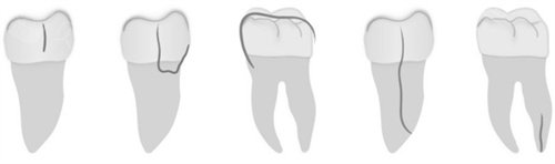 口腔修复液怎么用牙齿修复液真的有用吗？牙釉质修复液新消息来了，上市时间终于确定！_https://www.jmylbn.com_新闻资讯_第6张