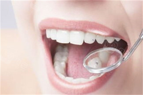 口腔修复液怎么用牙齿修复液真的有用吗？牙釉质修复液新消息来了，上市时间终于确定！_https://www.jmylbn.com_新闻资讯_第9张