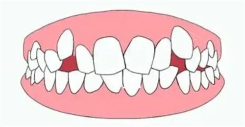 口腔修复液怎么用牙齿修复液真的有用吗？牙釉质修复液新消息来了，上市时间终于确定！_https://www.jmylbn.com_新闻资讯_第4张