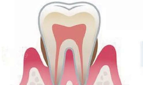 水激光牙周治疗多少钱一次？轻度/中度/重度费用差异大吗