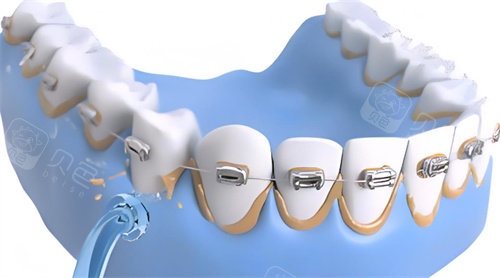 南京雨花台洗牙哪家好?本地牙友推荐博正口腔,服务细致口碑佳!