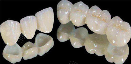 德国义获嘉全瓷牙怎么样？将从质量、优势、使用寿命、价格介绍！