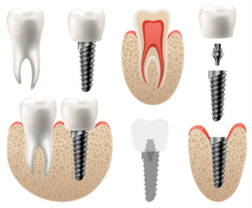 汕头市恒医口腔医院怎么样？是一家正规且靠谱的牙科，技术实力在线！