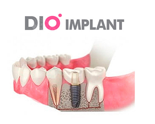 莱西牙科医院哪家比较好？莱西同元/正合/泉云口腔正规|种牙矫正口碑稳