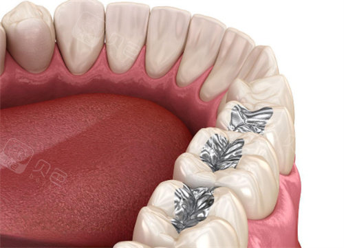 嘉兴雅卫仕口腔真实测评！看牙技术+收费标准全公开，看完再决定！
