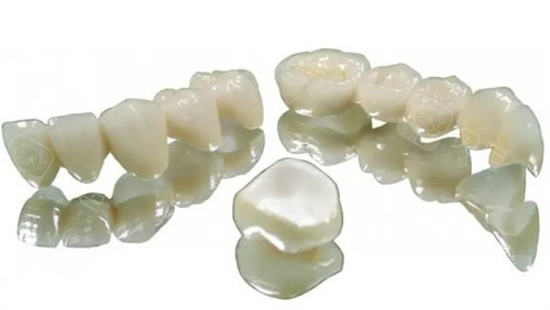 威兰德全瓷牙多少钱一颗？分享威兰德全瓷牙价格表、使用寿命及优缺点