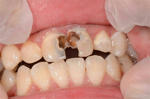 绵阳市盐亭县看牙科哪家好？分享两家靠谱牙科！