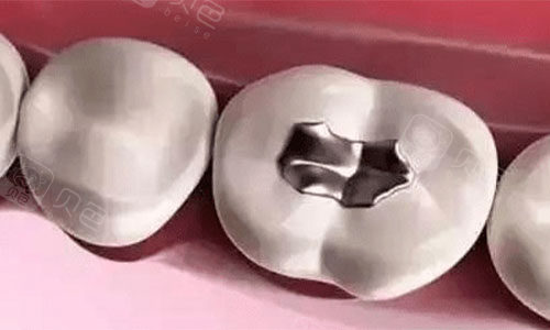 汉中市勉县靠谱牙科有哪些？网友整理排行前三是这三家！