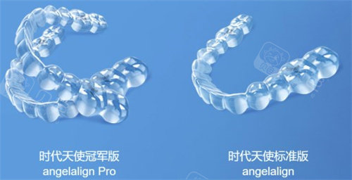 时代天使隐形牙套