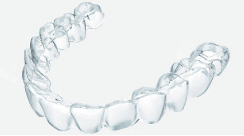 正雅隐形矫正适合什么人群?我学生党预算有限,正雅性价比拉满