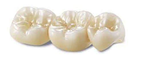 威兰德全瓷牙冠质量怎么样？多少钱一颗？使用寿命多久？