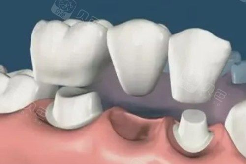 镶牙卡通图片一览