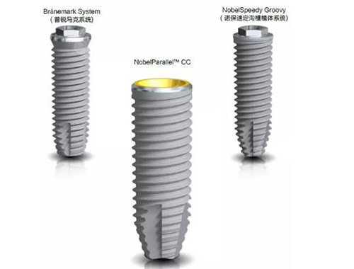 诺贝尔种植体示意图