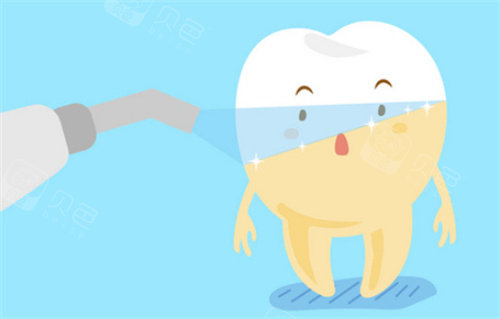 牙齿美白前后对比