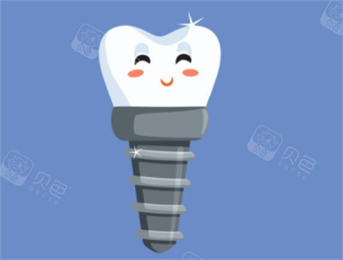 健康种植牙卡通图