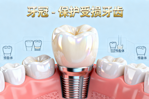 种植牙植入卡通一览