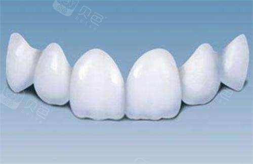 德系全瓷牙品牌怎么选？6大品牌深度解析，强度/美观/适配场景攻略