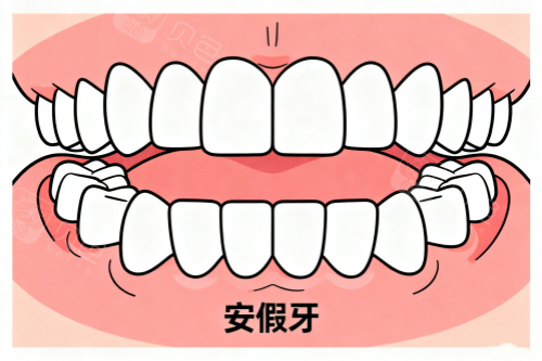 口腔护理包怎么用老年人假牙牙龈长包别慌!实用假牙款式+护理妙招,辈轻松解决困扰_https://www.jmylbn.com_新闻资讯_第3张