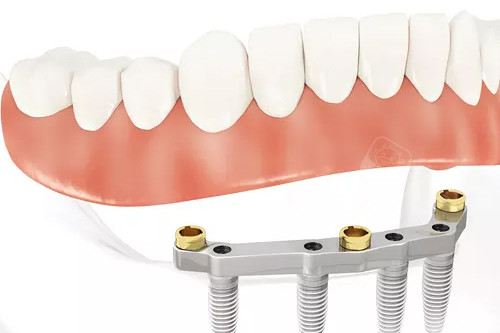 北京祥云紫京口腔怎么样？看牙好、技术正规、医生负责，各方面都值得信赖！
