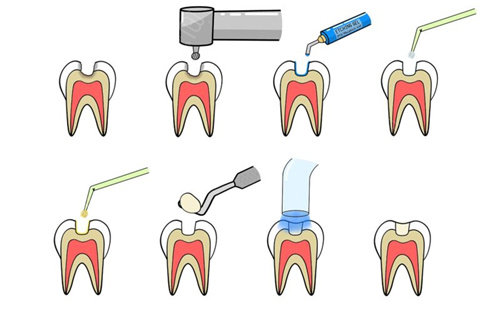 阿克苏雅致口腔好不好？是一家正规且很有性价比的牙科呢！