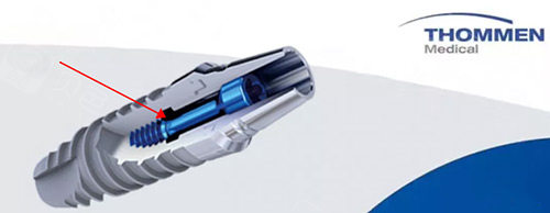 口腔种植手术包怎么打瑞士ITI骨水平和龈水平种植体的区别：差异包括植入位置、手术流程等_https://www.jmylbn.com_新闻资讯_第3张