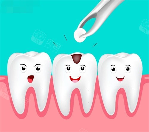 dmg口腔材料怎么使用常见十个补牙材料品牌盘点｜美国3M／义获嘉／VOCO／等全解析_https://www.jmylbn.com_新闻资讯_第2张